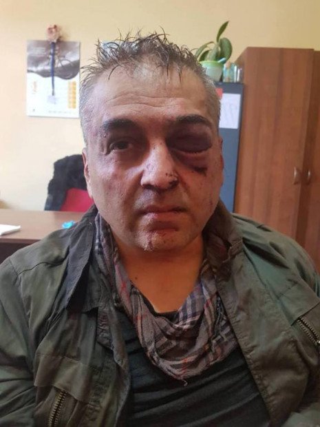 Узброены напад на банк у Ерэване здзейсніў палкоўнік дарожнай паліцыі