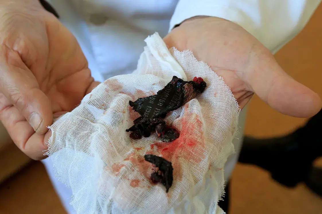 Артём пережил взрыв на Октябрьской: “До точки взрыва я не дошел 4 метра”