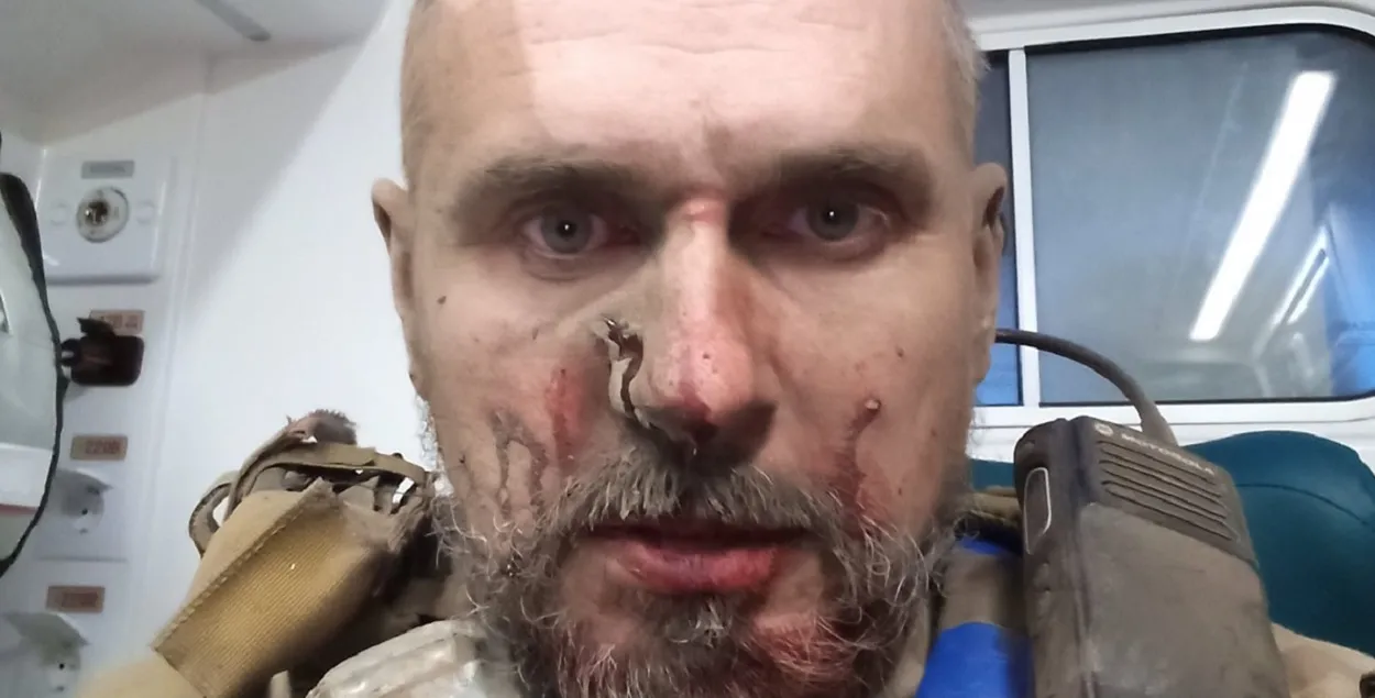 Олег Сенцов после ранения / https://www.facebook.com/oleg.sentsov/
