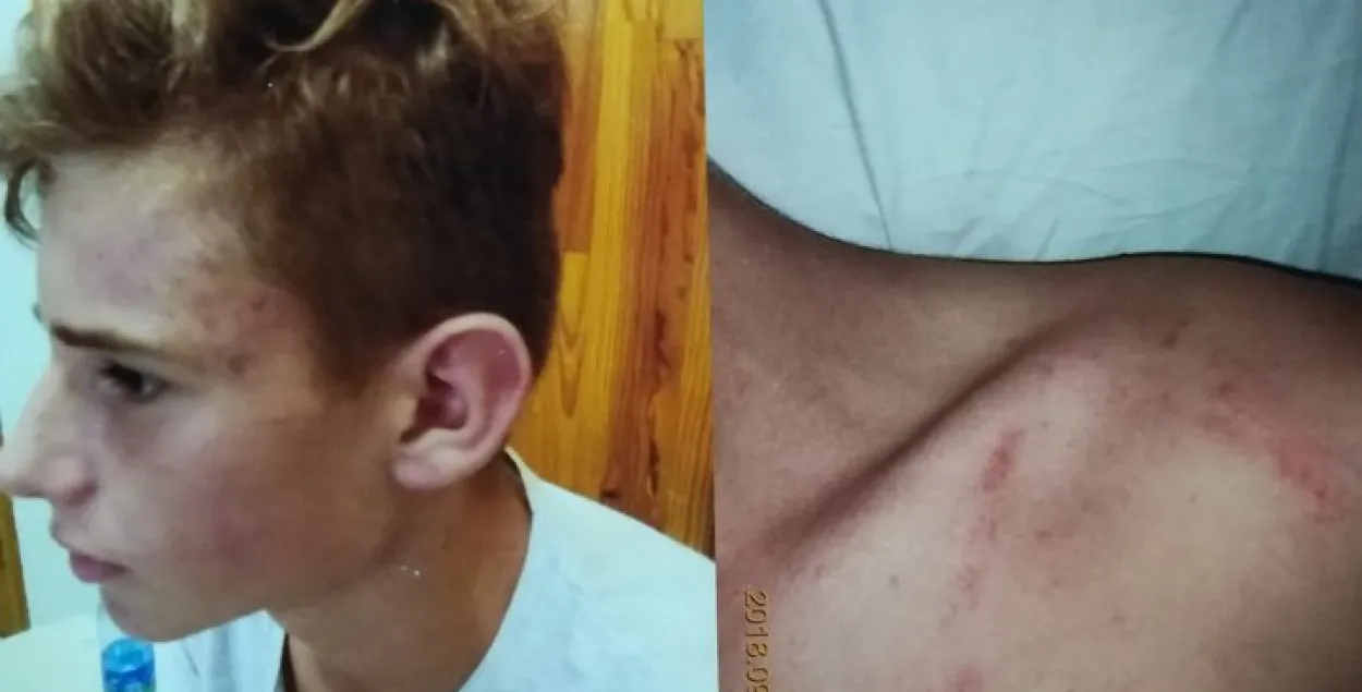 У Рагачове судзяць мужчыну, які збіў падлетка падчас дваровага футбола