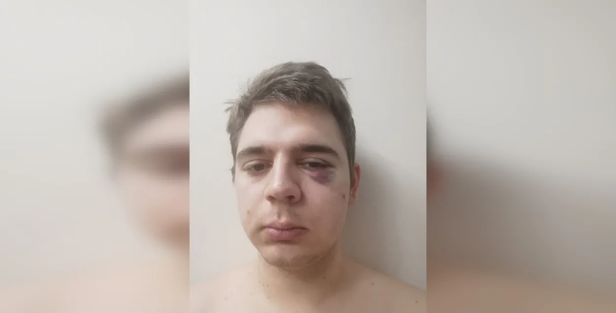 Били по голове, топтались по спине: одно задержание во время Марша смелых