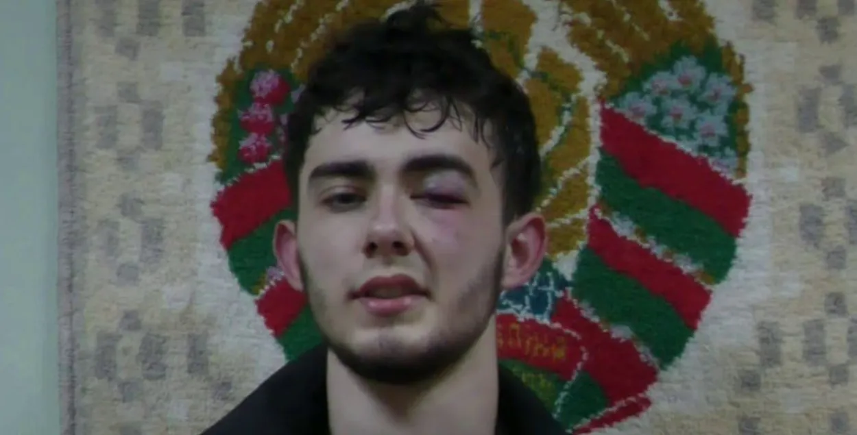 Гродненца избили и задержали за фото военных объектов
