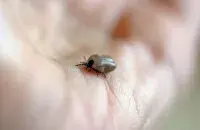 Ад нашэсця мошак пакутуюць зняволеныя жанчыны ў Гомельскай калоніі / pixabay.com, ілюстрацыйнае фота
