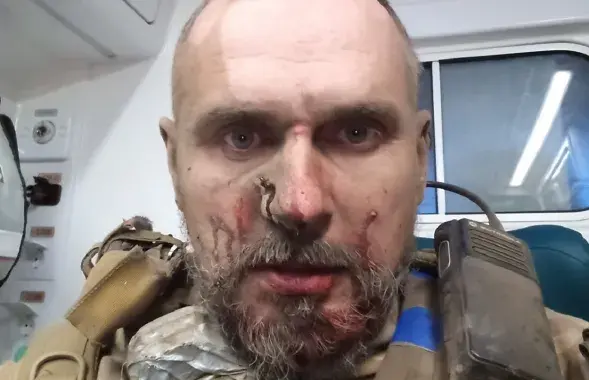 Олег Сенцов после ранения / https://www.facebook.com/oleg.sentsov/

