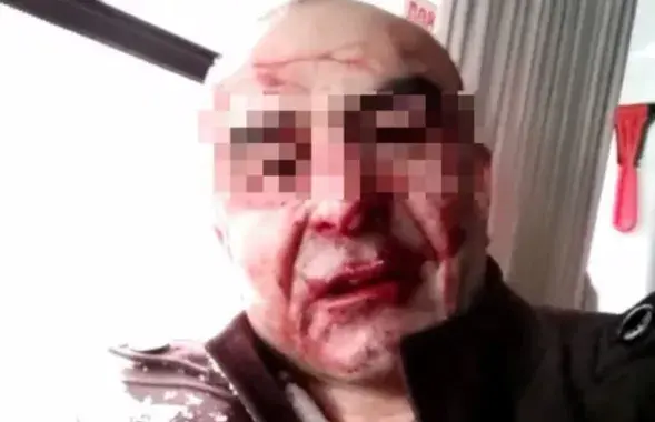 Задержанный за нападение на омоновца / fontanka.ru
